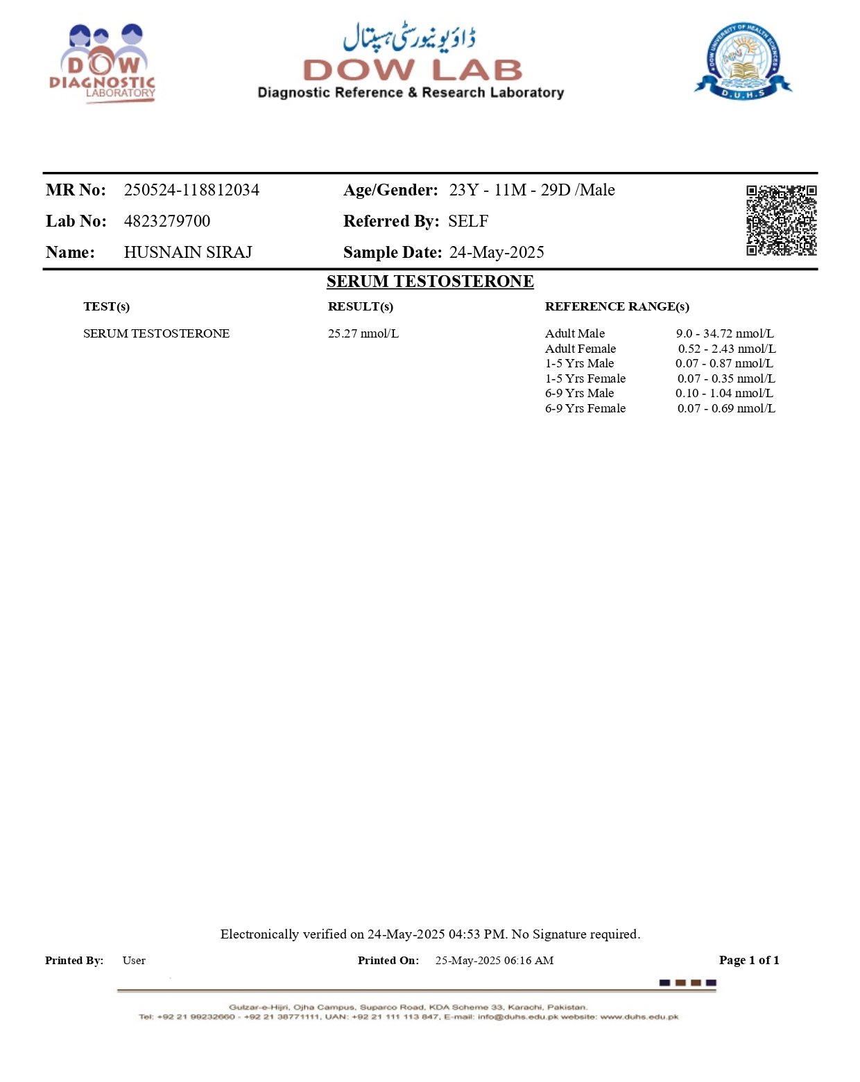 Serum testosterone lab report showing elevated testosterone levels after supplement use